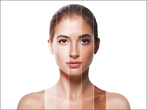 Chemical-peels-Bangalore